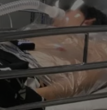 photo of sleeping patient 